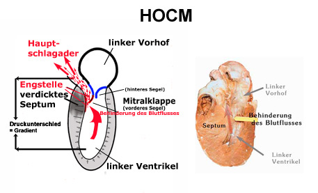 hocm Schema1