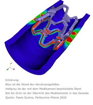 DES Stent Schema