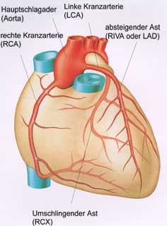 Herzkranzgefäße Grafik
