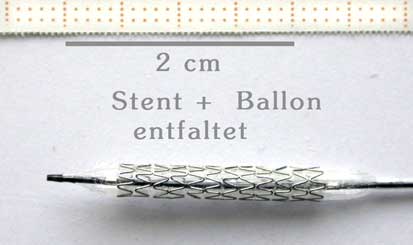 Bild Ballon und Stent entfaltet