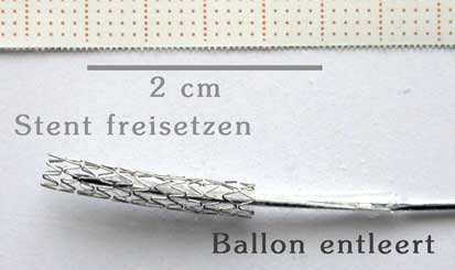 Bild Stent freisetzen 2