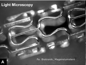 Magnesiumstent