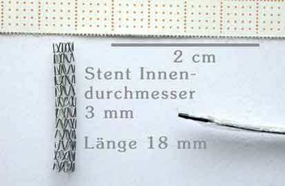 Bild Ballon Stent Maße